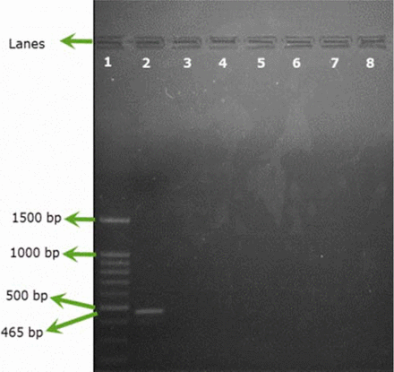 Figure 1A