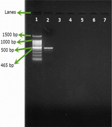 Figure 1B