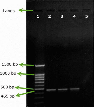 Figure 2A