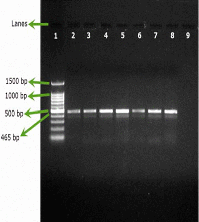 Figure 2B